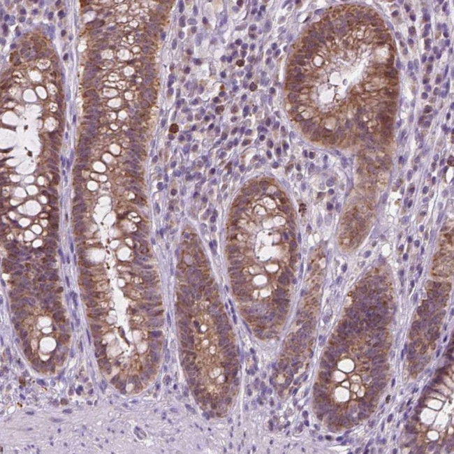 TTC9B Antibody in Immunohistochemistry (Paraffin) (IHC (P))