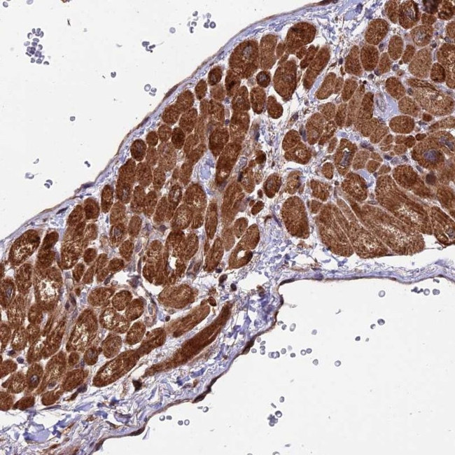 ESCO1 Antibody in Immunohistochemistry (IHC)
