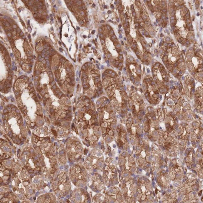 CCDC140 Antibody in Immunohistochemistry (Paraffin) (IHC (P))