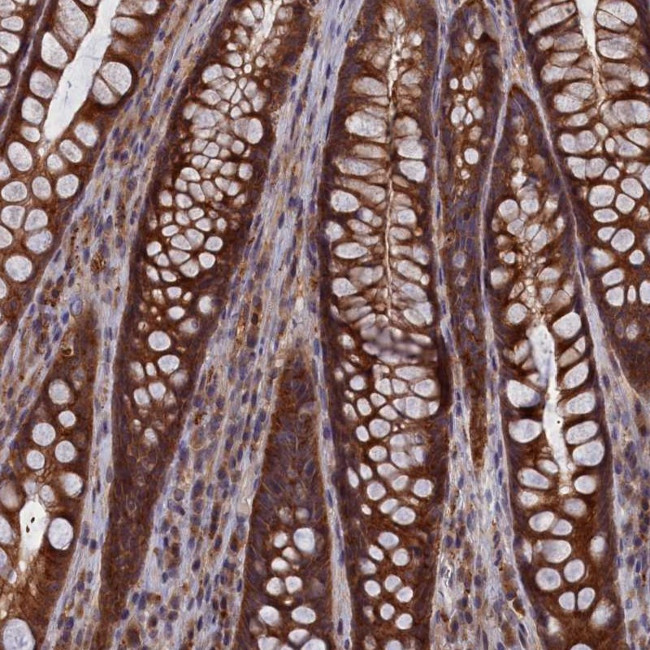 CACTIN Antibody in Immunohistochemistry (Paraffin) (IHC (P))