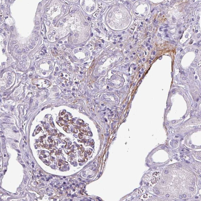 ATP10A Antibody in Immunohistochemistry (Paraffin) (IHC (P))