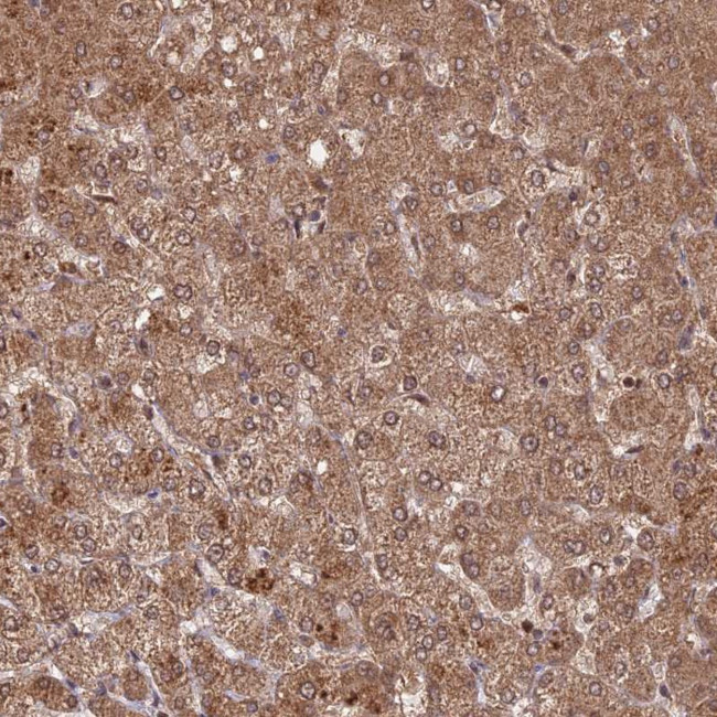 C2orf91 Antibody in Immunohistochemistry (Paraffin) (IHC (P))