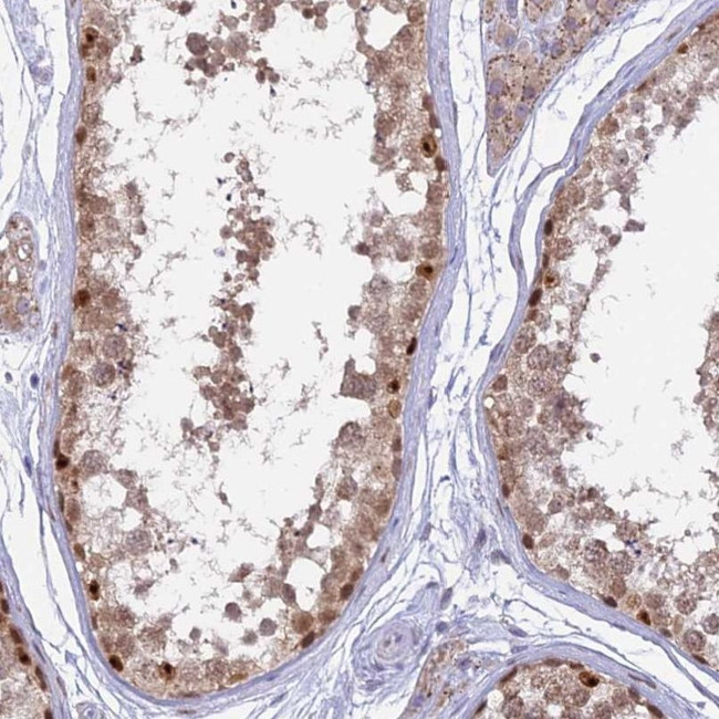 CENPV Antibody in Immunohistochemistry (IHC)