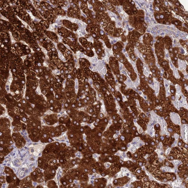N6AMT2 Antibody in Immunohistochemistry (Paraffin) (IHC (P))