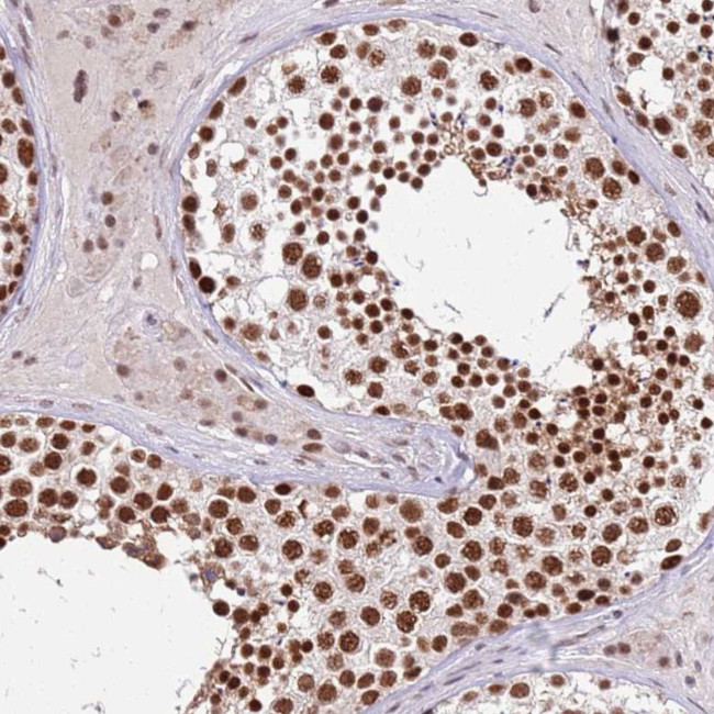 AKAP8L Antibody in Immunohistochemistry (Paraffin) (IHC (P))
