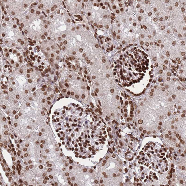H3F3A Antibody in Immunohistochemistry (Paraffin) (IHC (P))