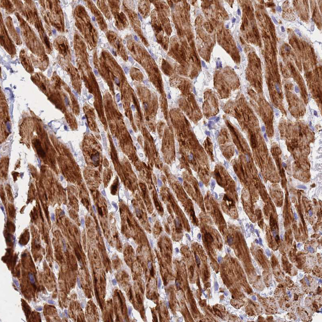 UQCRH Antibody in Immunohistochemistry (Paraffin) (IHC (P))