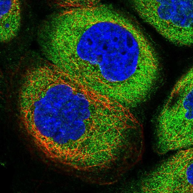 AdoHcyase 2 Antibody in Immunocytochemistry (ICC/IF)