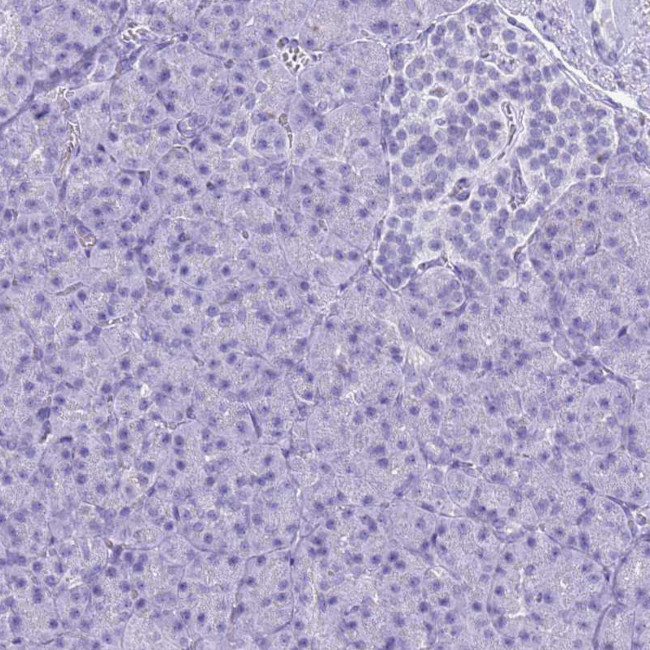 SLC7A9 Antibody in Immunohistochemistry (Paraffin) (IHC (P))