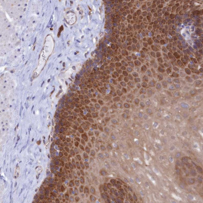 TMEM90A Antibody in Immunohistochemistry (Paraffin) (IHC (P))