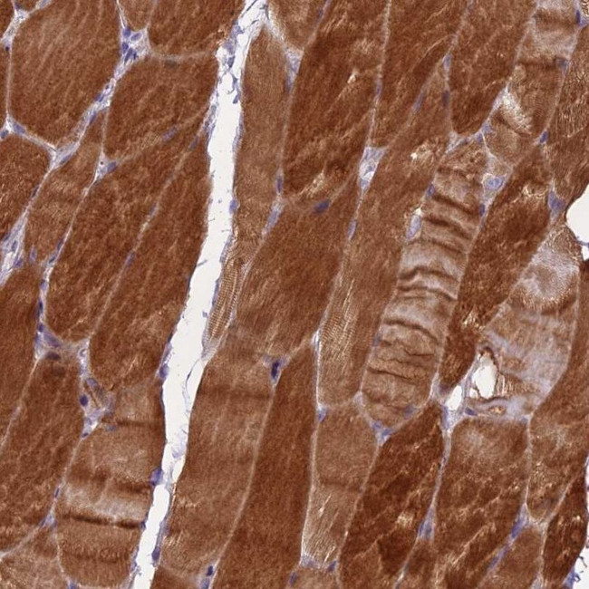 MEMO1 Antibody in Immunohistochemistry (IHC)