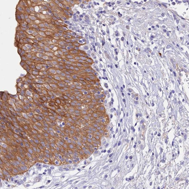 GK5 Antibody in Immunohistochemistry (Paraffin) (IHC (P))