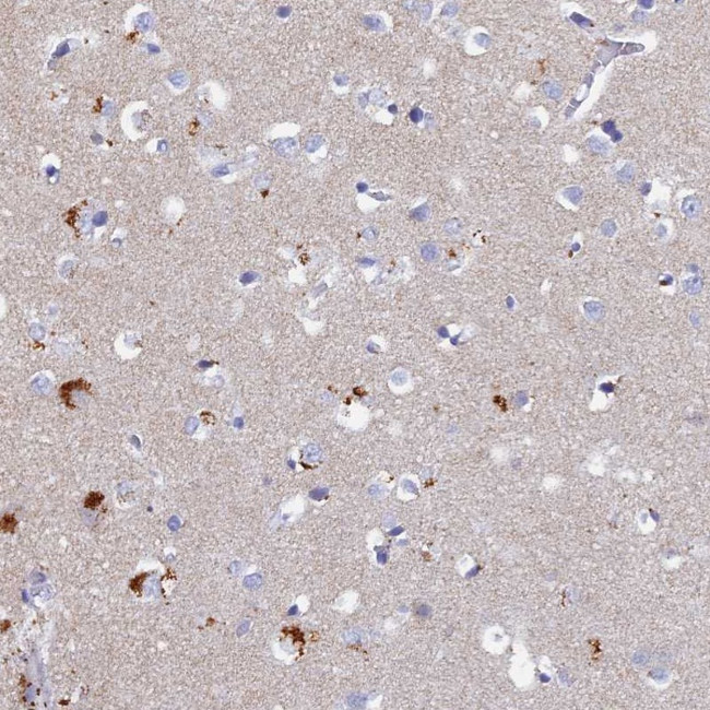 PAPL Antibody in Immunohistochemistry (Paraffin) (IHC (P))