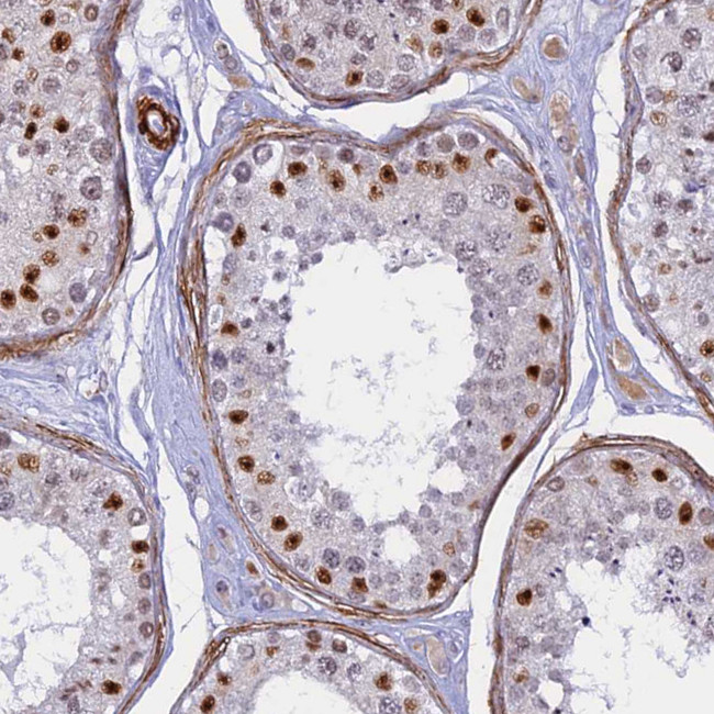 CENPV Antibody in Immunohistochemistry (Paraffin) (IHC (P))
