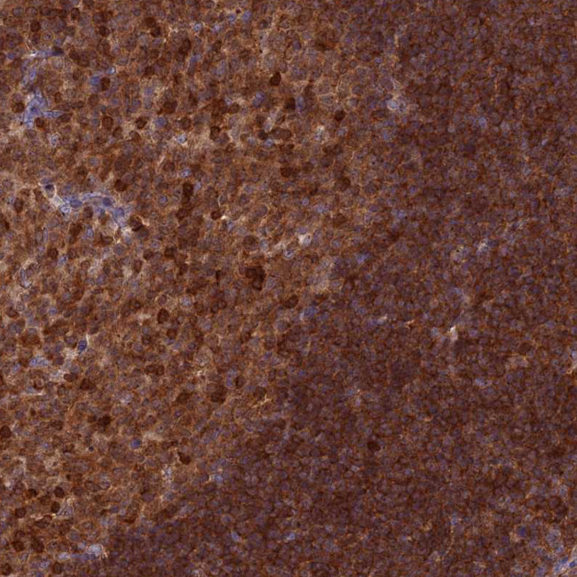 RPIA Antibody in Immunohistochemistry (Paraffin) (IHC (P))