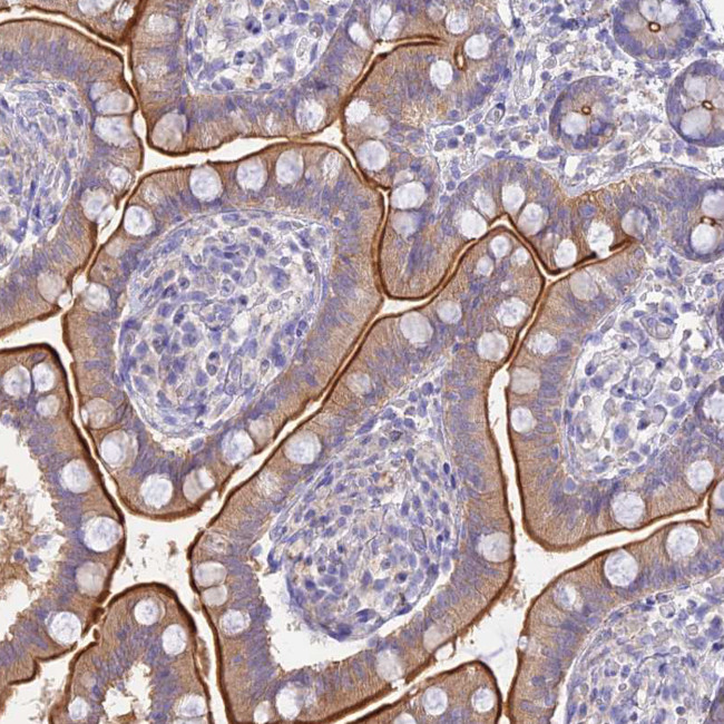 NALP9 Antibody in Immunohistochemistry (Paraffin) (IHC (P))