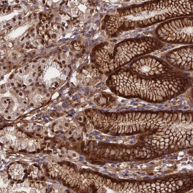 RBBP8NL Antibody in Immunohistochemistry (Paraffin) (IHC (P))