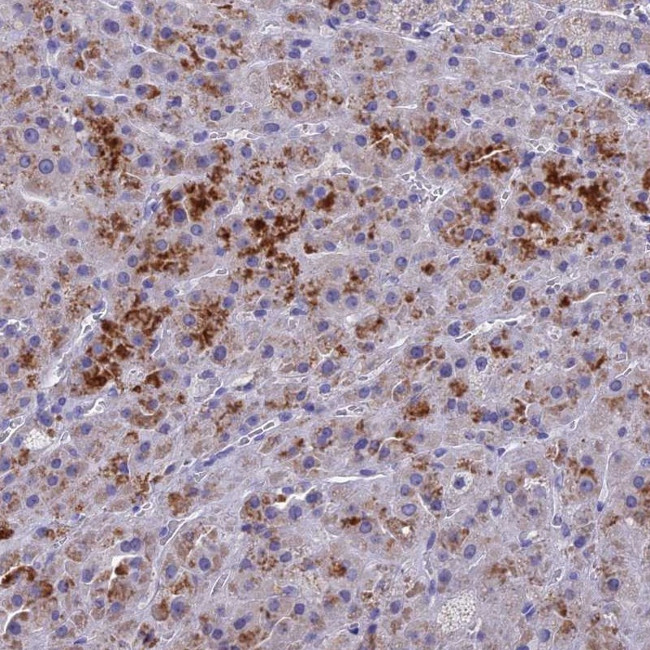 BTBD19 Antibody in Immunohistochemistry (Paraffin) (IHC (P))
