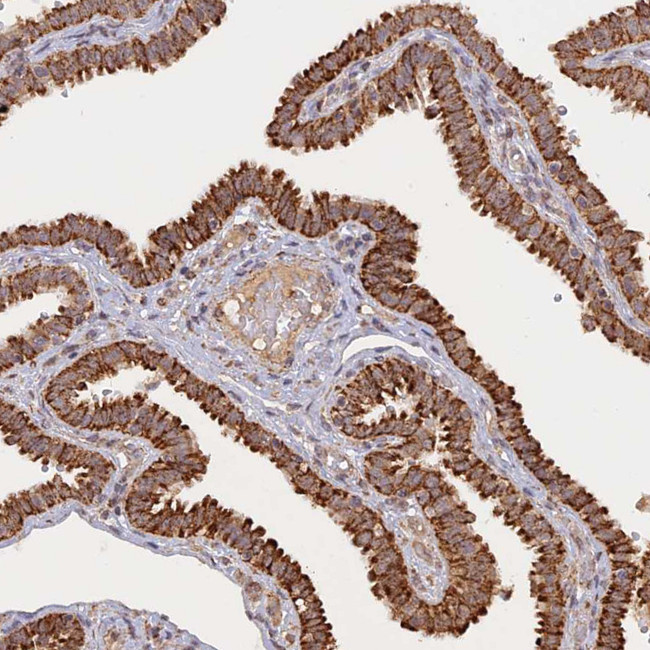 FAM210B Antibody in Immunohistochemistry (Paraffin) (IHC (P))