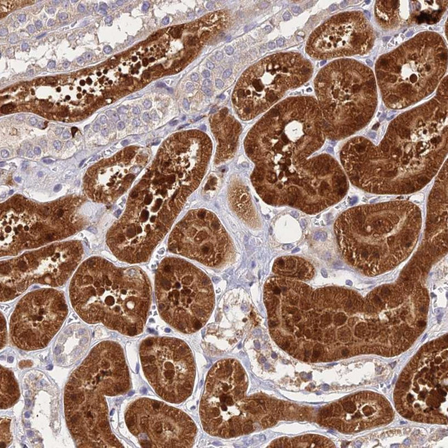 ASPDH Antibody in Immunohistochemistry (Paraffin) (IHC (P))