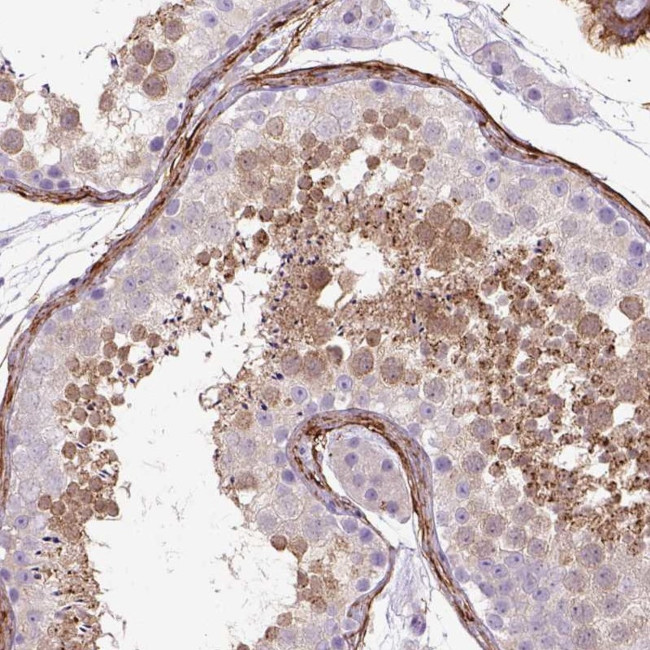 SIRP delta Antibody in Immunohistochemistry (Paraffin) (IHC (P))