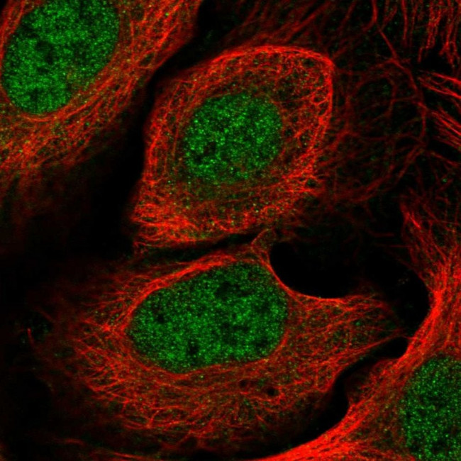CYB5RL Antibody in Immunocytochemistry (ICC/IF)