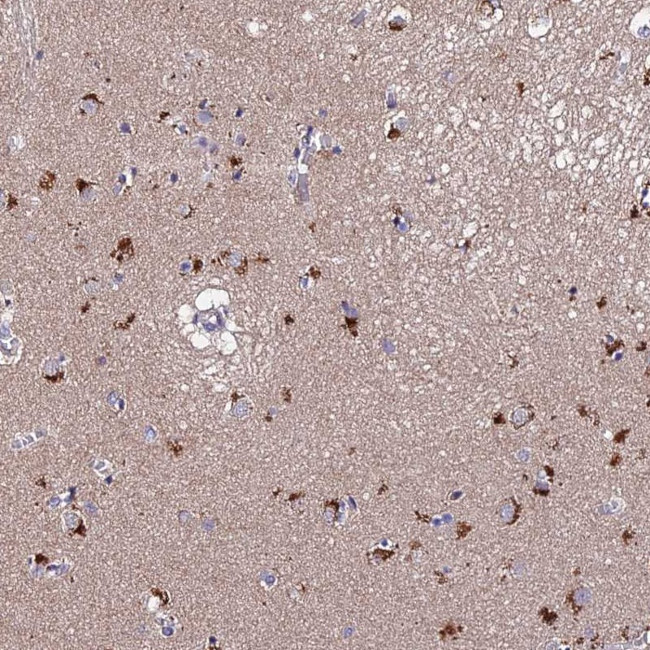 ACTR5 Antibody in Immunohistochemistry (Paraffin) (IHC (P))