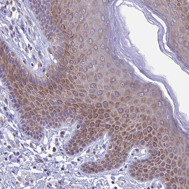 REEP4 Antibody in Immunohistochemistry (Paraffin) (IHC (P))