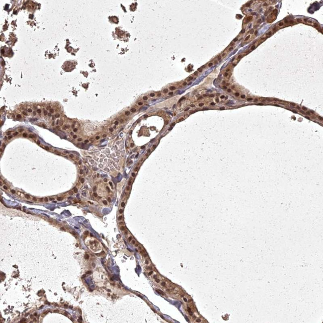 ING5 Antibody in Immunohistochemistry (Paraffin) (IHC (P))