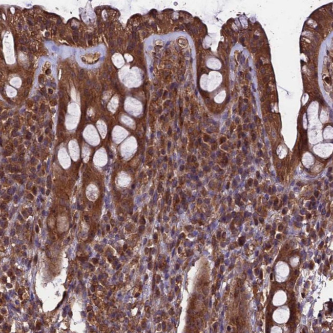TTLL10 Antibody in Immunohistochemistry (Paraffin) (IHC (P))