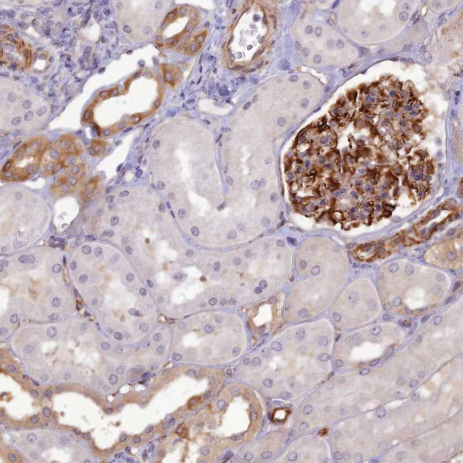 RGL3 Antibody in Immunohistochemistry (Paraffin) (IHC (P))