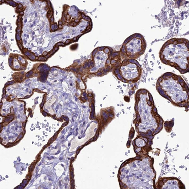 C20orf202 Antibody in Immunohistochemistry (Paraffin) (IHC (P))