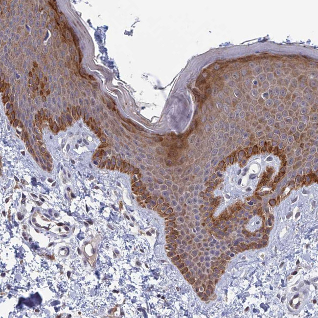 COX3 Antibody in Immunohistochemistry (Paraffin) (IHC (P))