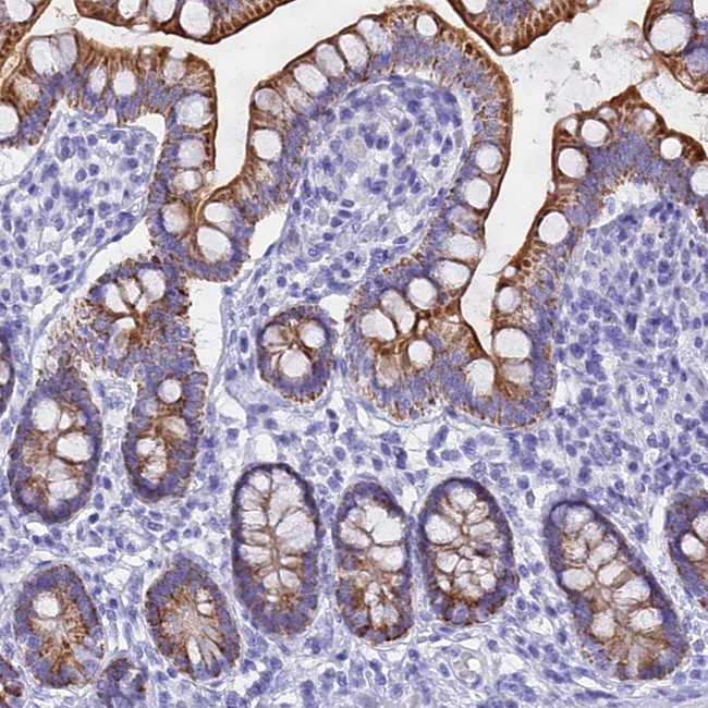 ISCA1 Antibody in Immunohistochemistry (Paraffin) (IHC (P))