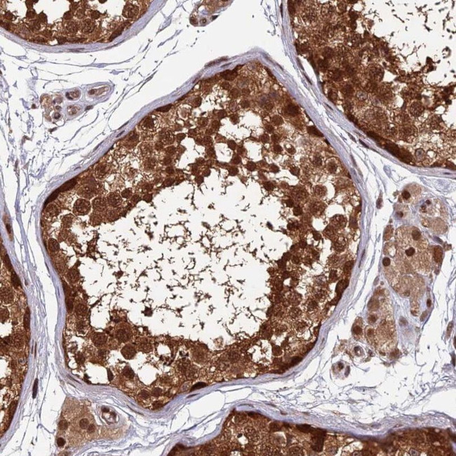 FAM53C Antibody in Immunohistochemistry (IHC)