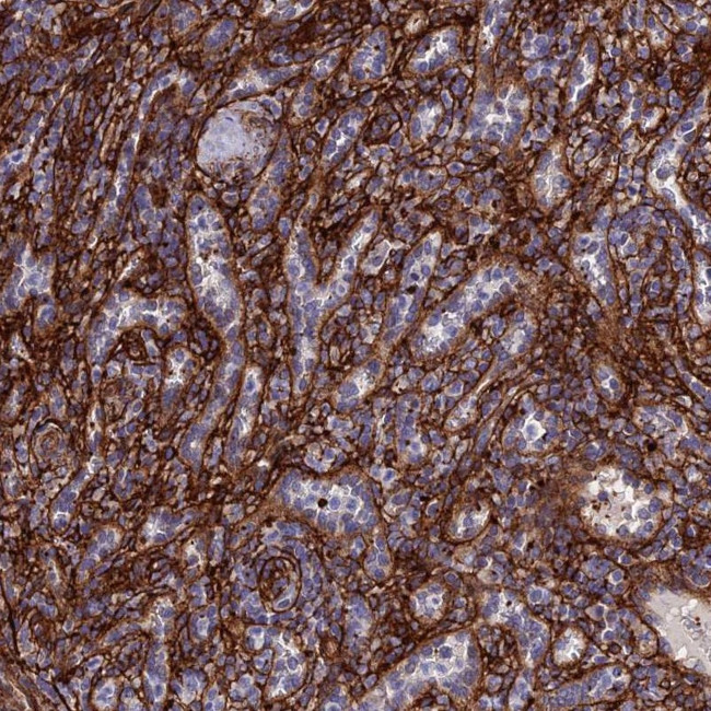 CCDC48 Antibody in Immunohistochemistry (Paraffin) (IHC (P))