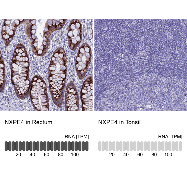 FAM55D Antibody in Immunohistochemistry (Paraffin) (IHC (P))