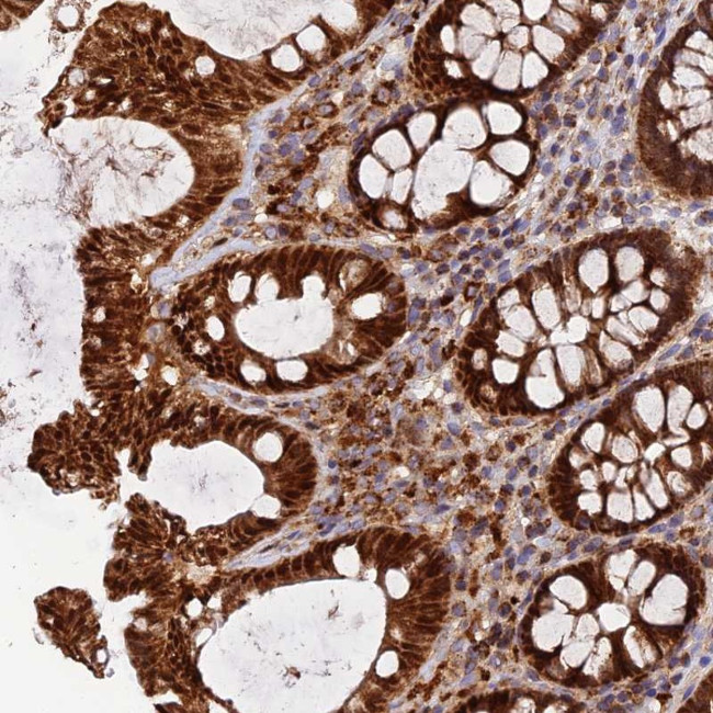 PODNL1 Antibody in Immunohistochemistry (Paraffin) (IHC (P))