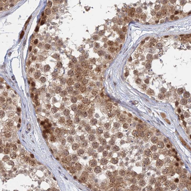 KIAA1257 Antibody in Immunohistochemistry (Paraffin) (IHC (P))