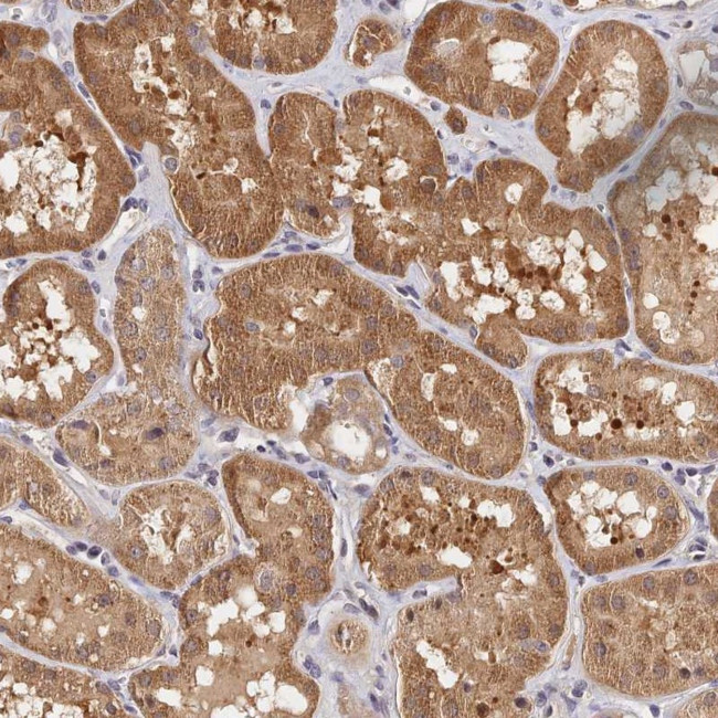 CWH43 Antibody in Immunohistochemistry (Paraffin) (IHC (P))