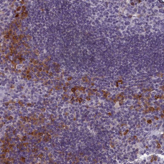 CNEP1R1 Antibody in Immunohistochemistry (Paraffin) (IHC (P))