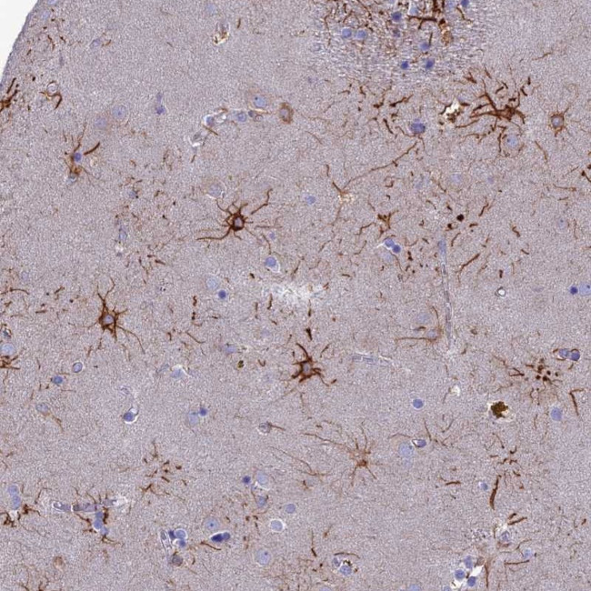 CYB561D2 Antibody in Immunohistochemistry (Paraffin) (IHC (P))