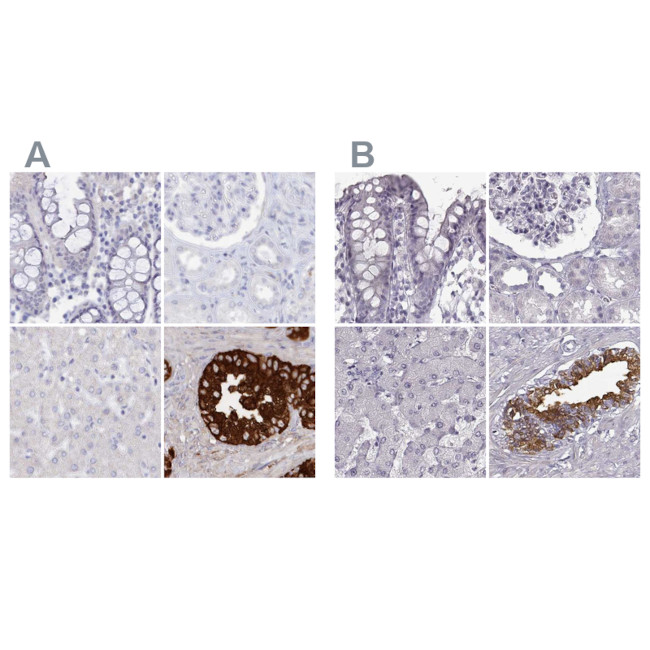 SEMG2 Antibody in Immunohistochemistry (IHC)
