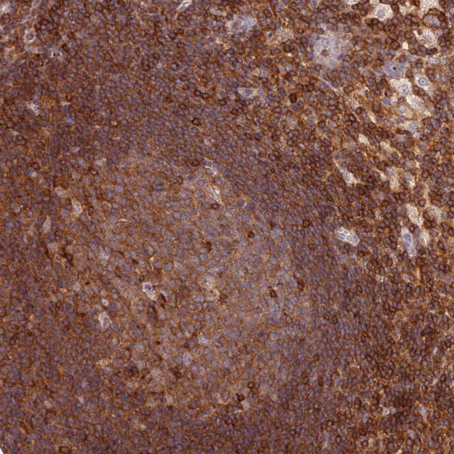 DENND1C Antibody in Immunohistochemistry (Paraffin) (IHC (P))