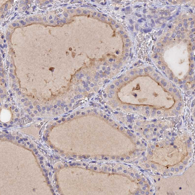 SLC26A4 Antibody in Immunohistochemistry (IHC)