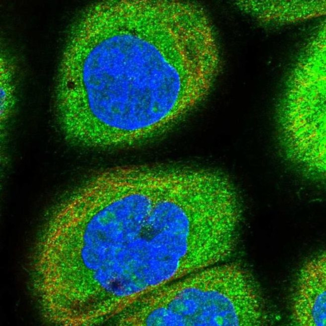 AROS Antibody in Immunocytochemistry (ICC/IF)