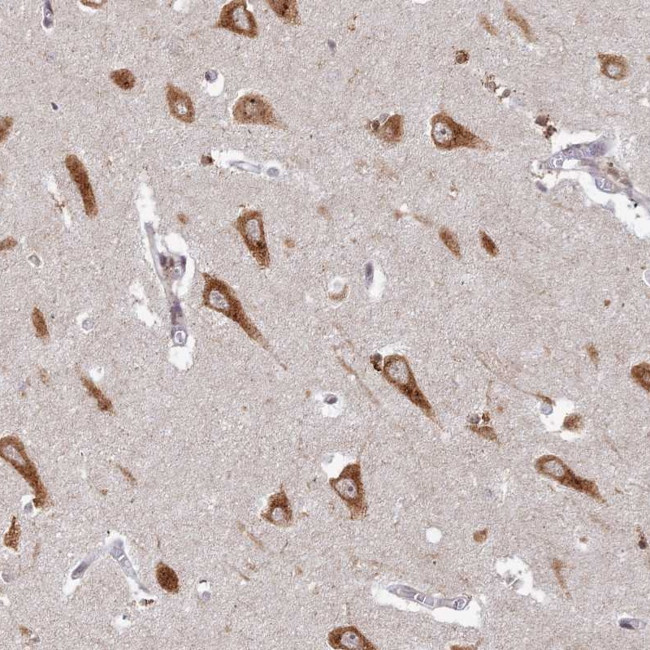 ABCA2 Antibody in Immunohistochemistry (Paraffin) (IHC (P))