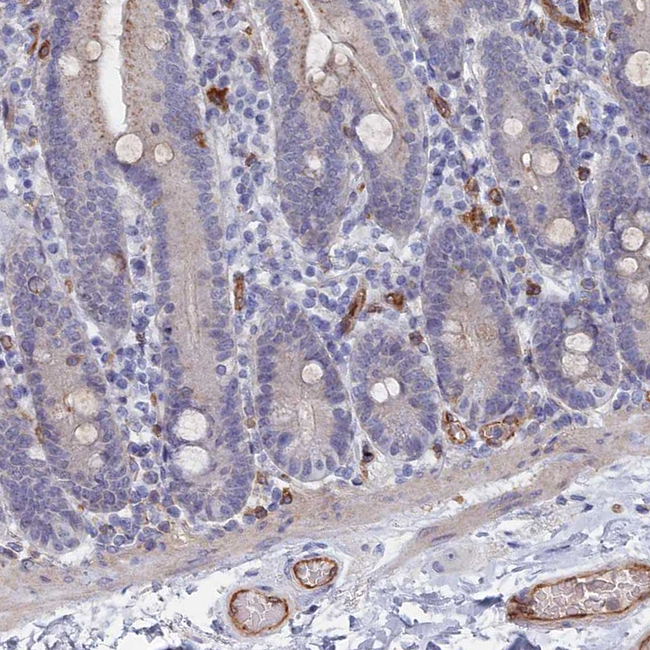 ARAP3 Antibody in Immunohistochemistry (Paraffin) (IHC (P))