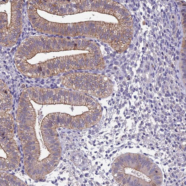 BSPRY Antibody in Immunohistochemistry (Paraffin) (IHC (P))