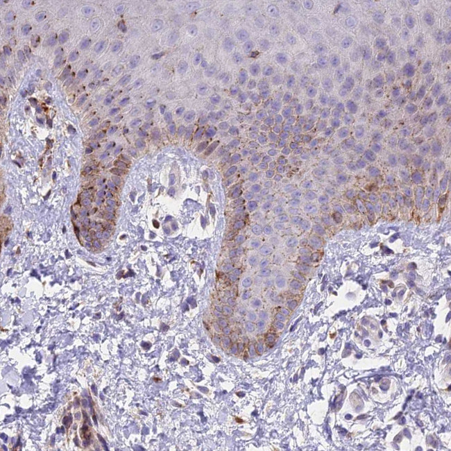 FRMPD1 Antibody in Immunohistochemistry (IHC)